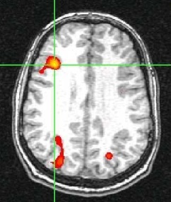 fMRI Map