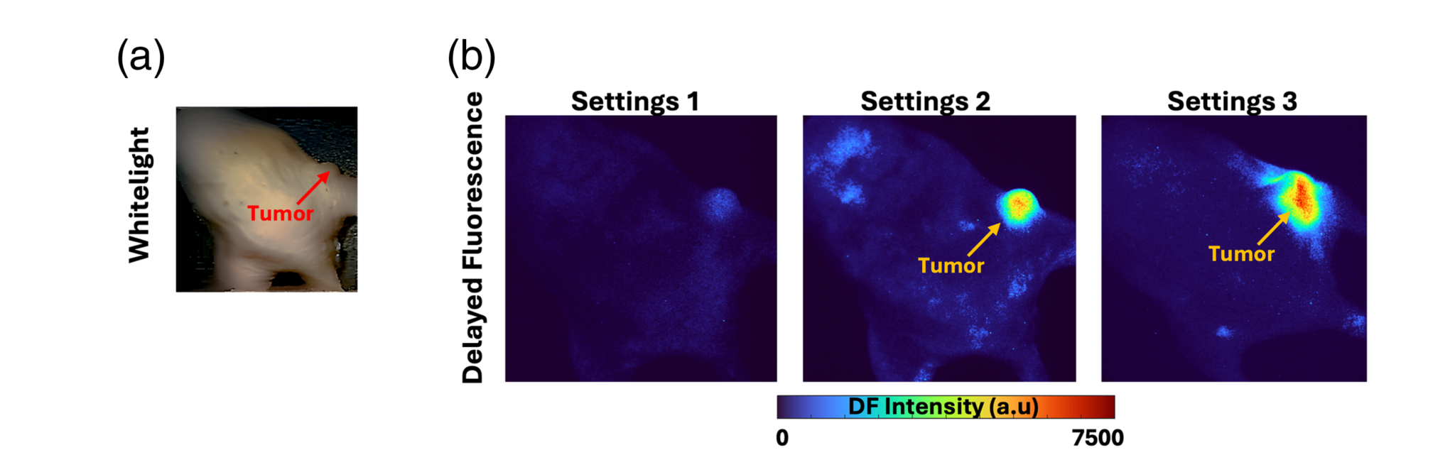 Research Spotlight: Enhanced porphyrin-based hypoxia imaging by ...